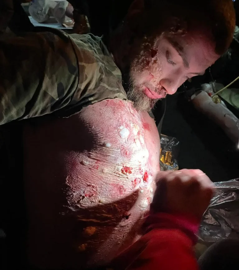 Realistyczna pozoracja urazu podczas szkolenia medycznego – Wintertide 2023