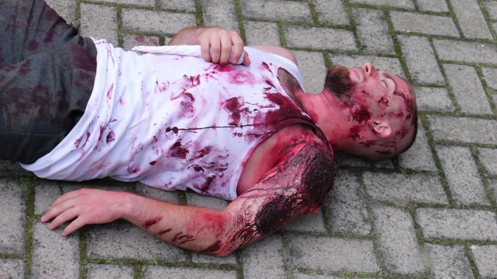 Pozorant z rozległymi ranami ramienia, ubrany w zakrwawioną białą koszulkę, leżący na ziemi podczas wydarzenia Tactical Public Rescue 2024.